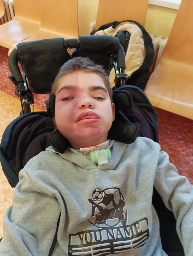 Rozhodli jsme se pomoci malému Lukáškovi 💙 Lukášek žije s velmi vážným zdravotním posti…